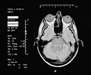MRI image #4