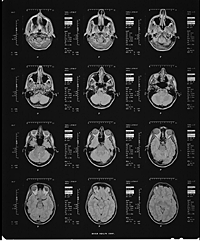 MRI image #3